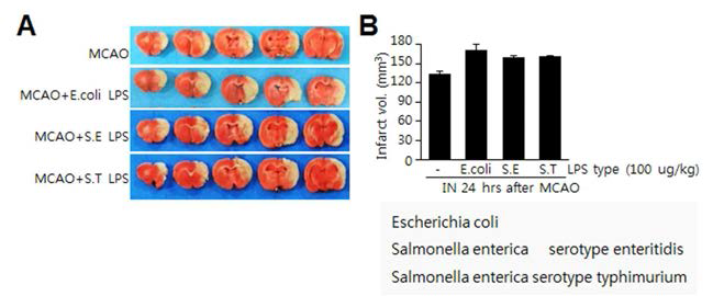 Salmonella enterica 로부터 분리한 serotype enteritidis와 Salmonella typhimurium으로부터 분리한 serotype typhimurium의 LPS를 MCAO (60 min) 동물 모델 제작 24 시간 후에 투여한 후 뇌경색 부피 조사