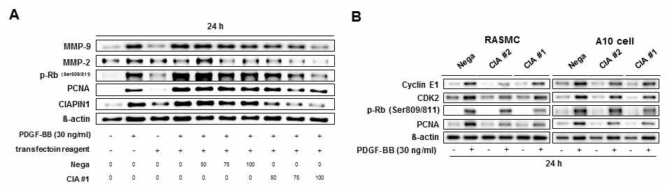 A and B. 혈관평활근세포에서 CIAPIN1 siRNA에 의한 증식 및 이동 관련 단백질의 변화