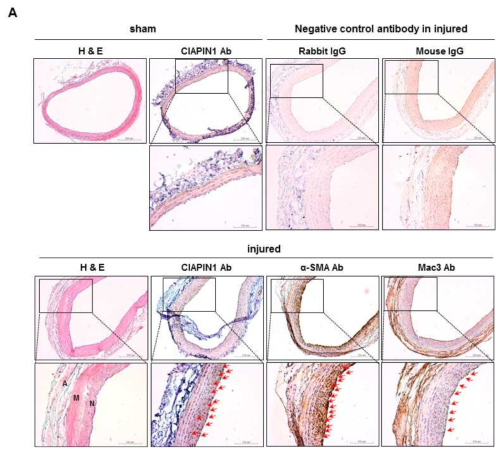 A. Balloon injury로 유도한 신생혈관내막증식모델에서 CIAPIN1의 발현 확인