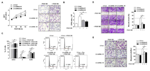 A-E. CIAPIN1 knockdown stable cell에서 PDGF-BB에 의한 (A) 증식, (B) DNA 합성 감소, (C) 세포 주기 S기 감소와 G0/G1 증가 및 (D and E) 이동 감소 확인