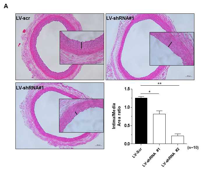 A. CIAPIN1 shRNA에 의한 신생혈관내막증식 억제 확인