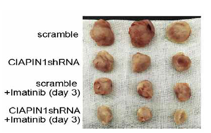 Xenograft 모델에서 shRNA와 Imatinib에 의한 cancer크기 감소 확인