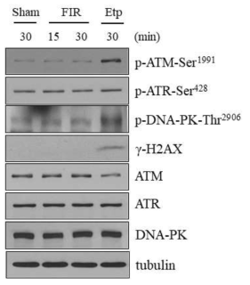원적외선 조사에 의한 ATM, ATR 혹은 DNA-PK 인산화 효소의 활성 분석