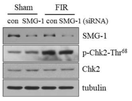 원적외선 조사에 의한 Chk2의 활성에 SMG1의 관련성 분석