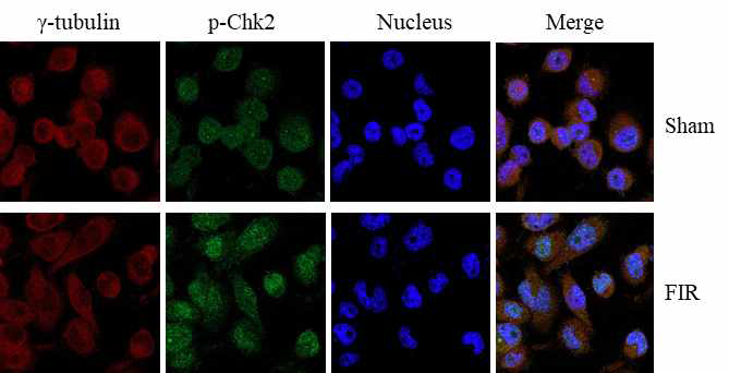 원적외선 조사에 의한 활성화된 Chk2의 세포내 위치 분석
