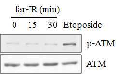 원적외선 조사에 의한 ATM 효소의 활성 변화