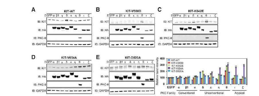 PKC 아형별 과발현에 따른 KIT 안정성 평가