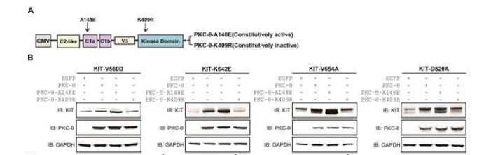 PKC-θ 돌연변이 발현에 따른 KIT 단백질의 안정성 조절