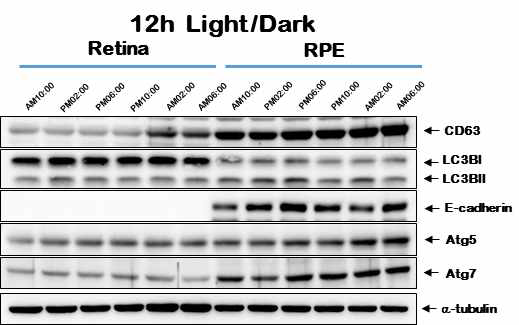 C57BL/6 마우스를 이용한 빛과 하루 주기 생체시계에 따른 망막과 망막색소상피의 자가포식 및 엑소좀 단백질을 전기영동을 이용해 확인