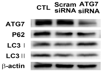 ARPE-19 세포에 Atg7 siRNA를 이용한 in vitro, Atg7 CKO (BEST1-cre;Atg7f/f) 모델에서의 자가포식 단백질을 전기영동 방법을 이용해 확인