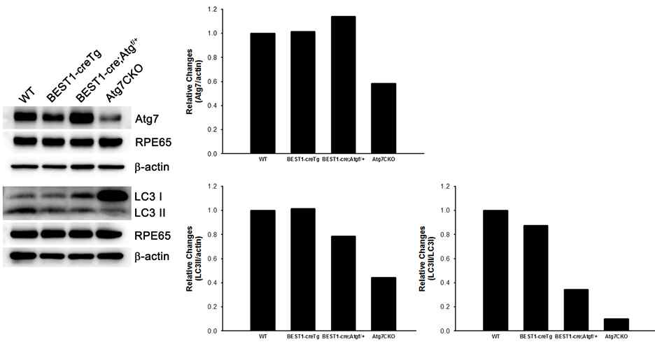 Atg7 conditional knockout mice를 이용한 망막과 망막 색소상피의 자가포식 단백질을 전기영동 방법을 이용해 확인