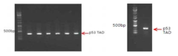 p53 TAD 단백질 cloning (좌) PCR product 의 agarose gel electrophoresis (중) Restriction enzyme digestion (우) colony PCR 을 통한 colony selection