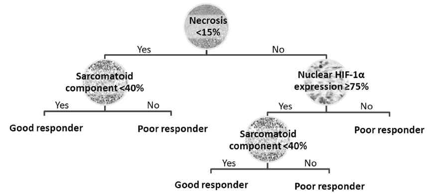 최종 예측인자로 선정된 괴사 (necrosis), 육종성 변화 (sarcomatoid component) 및 종양 핵 내 HIF1a발현을 이용한 decision tree
