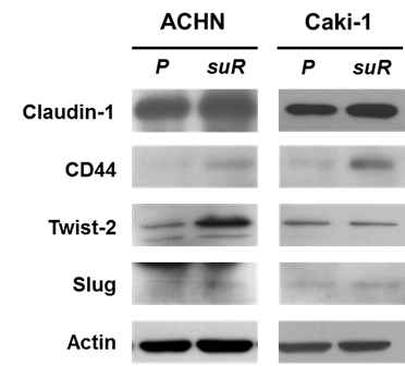 TKI-저항성 신장암 세포주의 EMT 관련 단백발현 분석. TKI-민감성 모 세포주(P)에 비해 TKI-저항성 세포주 (suR)에서 Twist-2, claudin-1, Slug, CD44 단백 발현의 증가