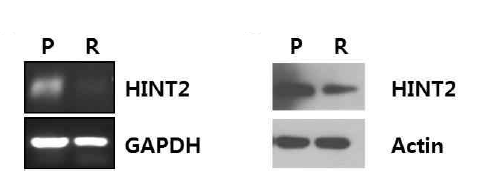 TKI-저항성 신장암의 HINT2의 발현. TKI에 민감한 parental A-704(P)와 TKI(Sutent)-저항성 A-704(R)의 HINT2 mRNA와 단백발현을 RT-PCR(좌)과 Western blotting(우)으로 확인함. TKI-저항성 신장 암세포주에서 HINT2의 발현이 감소함