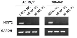 HINT2 유전자 발현억제를 위한 siRNA 제작. ACHN과 786-O 신장암 세포주에 HINT2 siRNA(#1, #2)를 도입 시 HINT2의 발현이 억제됨(RT-PCR)