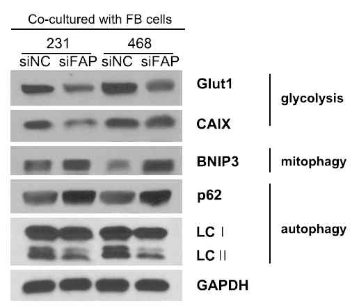 Differential expression of metabolic related proteins in co-cultured breast cancer cells with FB-siFAP. Breast cancer cells were co-cultivated with FB-siFAP cells for 48 h. Western blotting with the indicated antibodies was carried out using each breast cancer cell extracts from co-cultivated with FB-siFAP cells