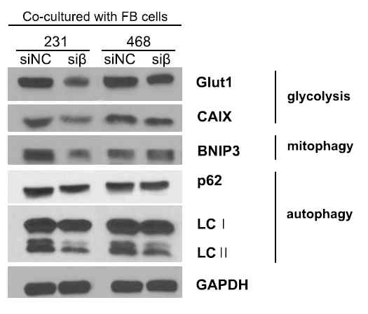 Differential expression of metabolic related proteins in co-cultured breast cancer cells with FB-siPDGFRβ. Breast cancer cells were co-cultivated with FB-siPDGFRβ cells for 48 h. The cell lysates were subjected to SDS-PAGE and performed by western blotting with anti-Glut1, anti-CAIX, anti-BINP3, anti-p62, anti-LC3B, and anti-GAPDH antibodies