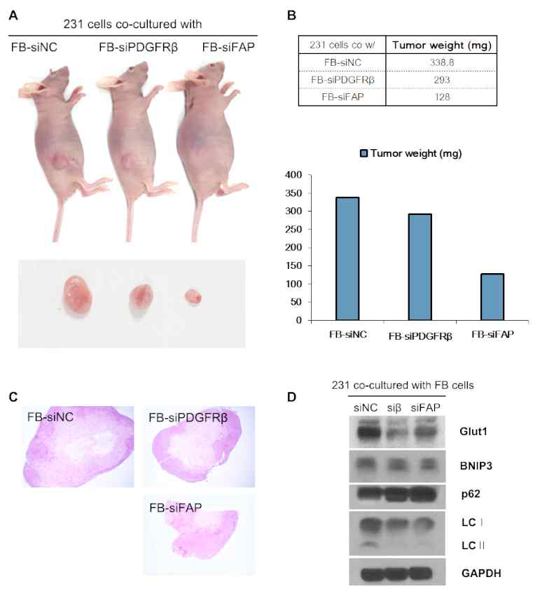 FB-siPDGFRβ and FB-siFAP cells inhibit primary tumor growth in MDA-MB-231 mouse model. (A) Primary tumor in mice 6 weeks after subcutaneous injection of MDA-MB-231 cells co-cultured with FB-siPDGFRβ and FB-siFAP cells. (B) Graphs represent tumor weight measured after isolation of primary tumor. (C) H&E stained mouse tumor images (D)Total lysates from each tissue were subjected to SDS-PAGE and blotted with the indicated antibodies