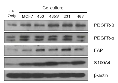 Differential expression of CAF-related proteins in co-cultured BJ-5ta fibroblasts with breast cancer cell lines. Western blotting with the indicated antibodies was carried out using BJ-5ta fibroblasts extracts from co-cultured with breast cancer cells