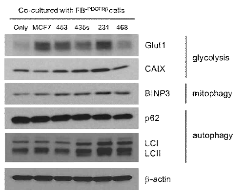 Differential expression of metabolic related proteins in co-cultured breast cancer cells with FB-PDGFRβ. Breast cancer cells were co-cultivated with FB-PDGFRβcells for 48 h. The cells lysates were subjected to SDS-PAGE and performed by western blotting with anti-Glut1, anti-CAIX, anti-BINP3, anti-p62, anti-LC3B, and anti-b-actin antibodies