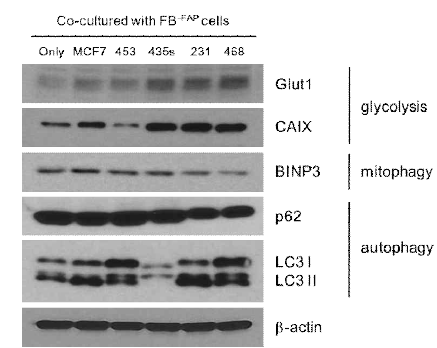 Differential expression of metabolic related proteins in co-cultured breast cancer cells with FB-FAP cells. Breast cancer cells were co-cultivated with FB-FAPcells for 48 h. Western blotting with the indicated antibodies was carried out using each breast cancer cell extracts from co-cultivated with FB-FAP cells