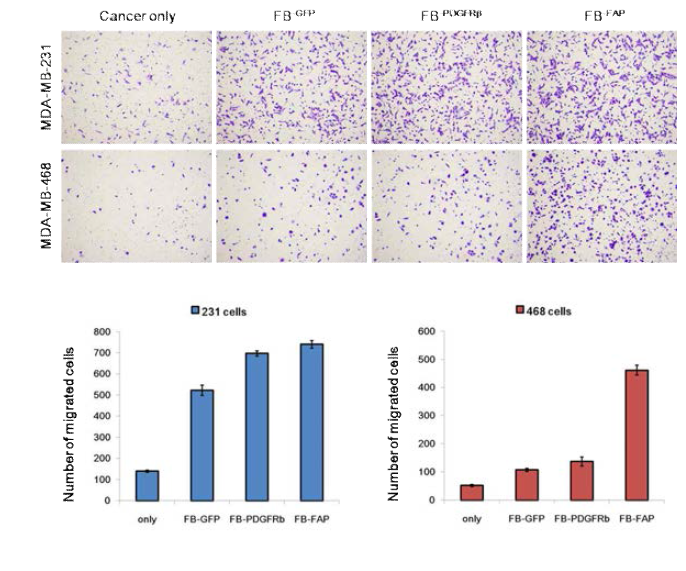 Cancer related FB-PDGFRβ and FB-FAP cells activate migration of MDA-MB-231 and MDA-MB-468 cells. Cancer cells were cultured with FB-GFP , FB-PDGFRβ, FB-FAP, or medium (control) respectively. Migrated cells attached to the lower surface of the filter were fixed, stained with crystal violet, and counted in five randomly selected fields in each membrane using bright-field microscopy