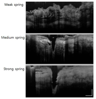 란셋 용수철 장력에 따른 공막 촬영 결과. (상) 약 (중) 중 (하) 강. (Scale bar: 100 μm)
