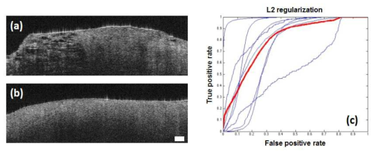 (a-b) 유방조직의 OCT 영상 결과. (a) 정상 조직, (b) 암조직. (c) L2 Regularization을 사용하여 획득한 Receiver Operating Characteristic (ROC) 결과. Scalebar: 100 μm