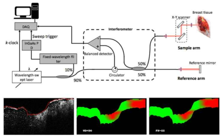 광 간섭 단층영상 장비 모식도 및 심층신경망 기능을 적용한 유방 조직 내 종양 분포도 결과