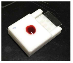 전혈을 떨어뜨린 후의 초간단 측정 칩의 사진
