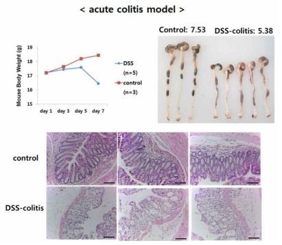 Establishment of DSS-induced acute colitis model in mouse: reduction of body wight and colon length showing expanded lumen with loss of epithelial cells and villus