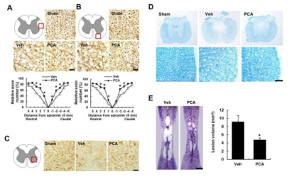 (A, B) Immunohistochemistry for NF-200 and axon counting. (C) Serotonergic neuron staining by 5-HT antibody. (D) Luxol fast blue for myelin staining. (E) Cresl staining and lesion volume