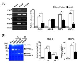 (A) RT-PCR for Jmjd3, Mmp-2, Mmp-3, Mmp-9, (B) Enzymatic activity assay