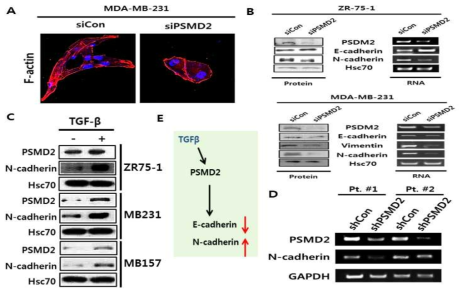 PSMD2에 의한 EMT 유도