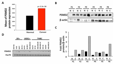 PSMD2의 발현 : TCGA, Normal vs. Cancer, 세포주 스크리닝