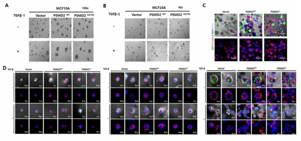 normal 세포주에 PSMD2의 발현을 overexpression 시켰을 때의 3D invasion 및 morphogenesis