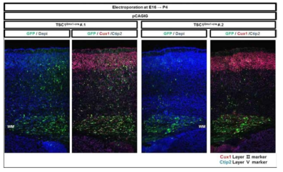 조건부 결핍 TSC1 마우스 2마리의 신경세포 이주장애 확인