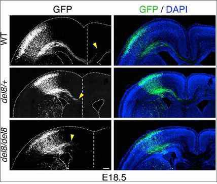 자폐마우스 모델에서의 신경세포 축삭돌기의 길이 저해 보고 (Hori K et al., 2014)