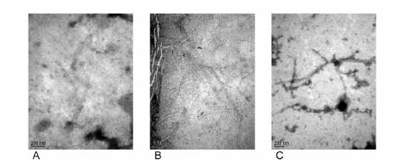 CTX phage의 전자 현미경 사진. (A): CTX-1, (B): CTX-2, (C) CTX-O139