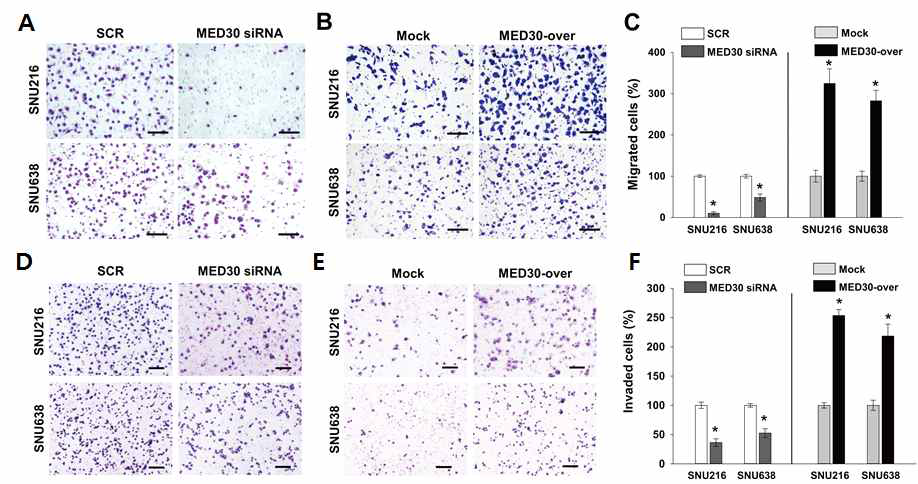 MED30유전자를 위암세포주에 과발현시켰을 때, 세포이동 및 침윤이 증가함을 관찰할 수 있었으며 (D, E, F), MED30유전자의 siRNA를 처리하였을 경우 그 반대의 효과를 관찰하였음 (A, B, C)