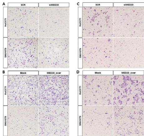 MED30유전자를 담도암세포주에 과발현시켰을 때, 세포이동 및 침윤이 증가함을 관찰할 수 있었으며 (C, D), MED30유전자의 siRNA를 처리하였을 경우 그 반대의 효과를 관찰하였음 (A, B)