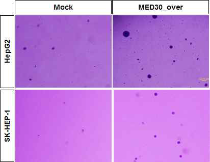 MED30유전자를 위암세포주에 과발현시켰을 때, sphere 형성능이 현저하게 증가됨을 관찰하였음