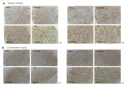 LPS 전신염증모델; LPS dose에 따른 소교세포 활성화 (Iba1 immunohistochemistry) A. 대뇌피질 (왼쪽; X10, 오른쪽; X20), B. 중뇌흑질 (왼쪽; X10, 오른쪽; X20)