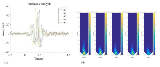 (가) 좌측 primary auditory cortex에서 관찰된 각 모음에 따른 ERP와 (나) time frequency analysis 결과