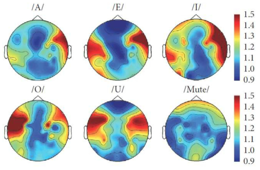 5번 피험자에 대한 음성 상상 동안의 뇌파의 감마 영역 활동의 topographical 분포