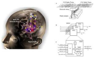 Hippocampus 인지 보철 개념도
