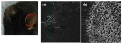 100 kHz 펄스 반복율을 갖는 나노초 펄스 레이저를 이용한 쥐 (mouse) 모델에서의 귀피부에서의 깊이에 따른 혈관 (a) 및 피부 표면 (b) 광음향 영상