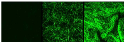 콜라겐 섬유 합성의 3차원 SHG 이미징 결과