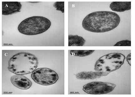 TEM으로 확인한 UV 조사, 무선주파수 가열, 그리고 조합 처리에 의한 Cronobacter sakazakii 세포막 손상정도 (A) 대조군, (B) UV 조사, (C) 무선주파수 가열, (D) UV-무선주파수 조합처리